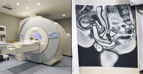 vagina gif|An inside view of sex: MRI scanner captures intercourse as you。